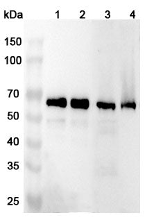 Anti-Human UBAP1 Polyclonal Antibody binds to Recombinant Human UBAP1 Protein, N-His in WB Assay