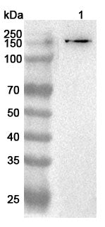 Anti-Mouse MATN2 Polyclonal Antibody binds to Recombinant Mouse MATN2 Protein, N-His in WB Assay