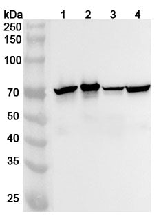 Anti-NEFL Polyclonal antibody binds to Recombinant Human NEFL, N-His in WB Assay