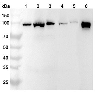 Anti-PDCD6IP Polyclonal antibody binds to Human PDCD6IP Recombinant Protein, N-His in WB Assay