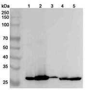 Anti-PSCA Polyclonal antibody