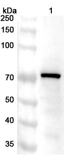 Anti-RPA1 Polyclonal Antibody binds to Recombinant Human RPA1 Protein, N-His in WB Assay