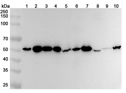 Anti-ST13 Polyclonal Antibody binds to Recombinant Human ST13 Protein, N-His in WB Assay