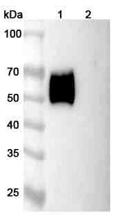 Human CD116/CSF2RA Monoclonal Antibody