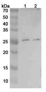 Mouse TNFa/TNF-alpha Polyclonal Antibody