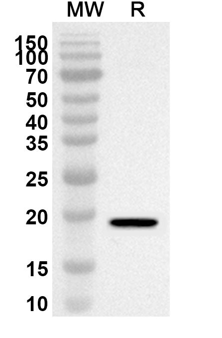 Recombinant Human CRABP2, N-His in WB Assay