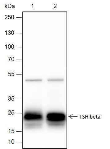 Anti-Human/Rat/Mouse FSH beta Antibody [A407] - ABMIUM