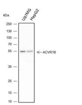 Anti-Human/Mouse Activin A Receptor Type IB/ALK-4 Antibody [A122]