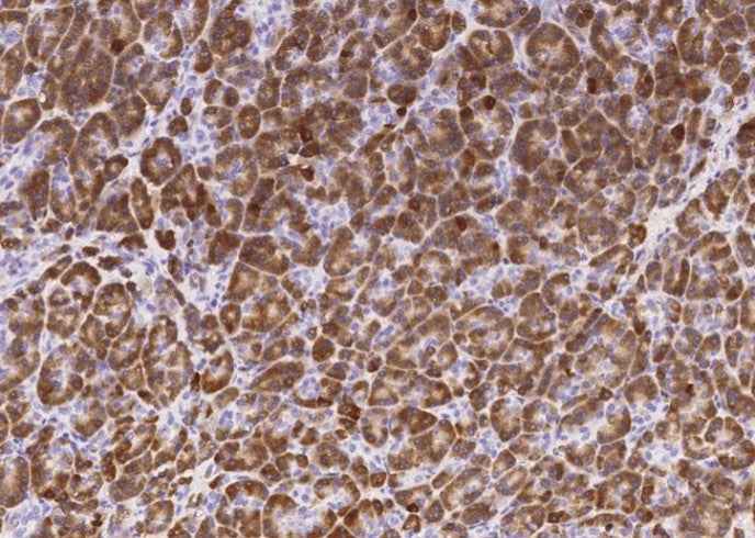 Anti-Human CPB1 Antibody [B109] - ABMIUM
