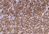 Anti-Human CPB1 Antibody [B109]
