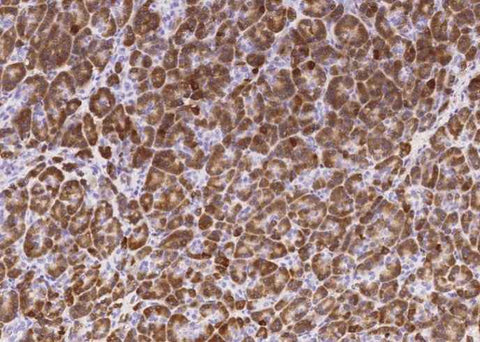 Anti-Human CPB1 Antibody [B109] - ABMIUM