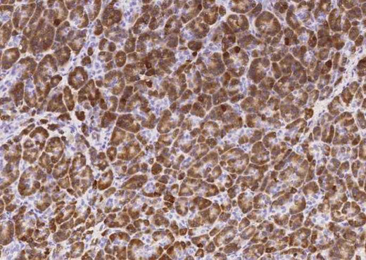 Anti-Human CPB1 Antibody [B109] - ABMIUM