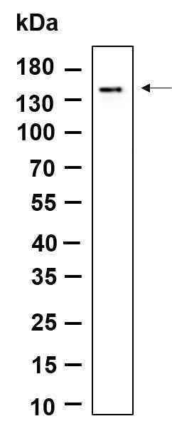 Anti-Human/Mouse/Rat MDA5 Antibody [B946] - ABMIUM