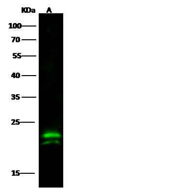Anti-Human CMPK1 Antibody [A992] - ABMIUM