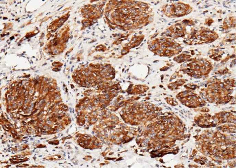 Anti-Human CD63 Antibody [A850] - ABMIUM