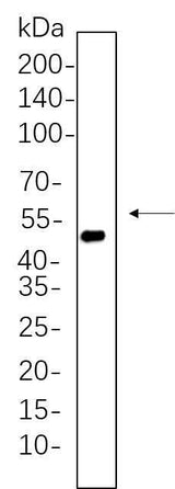 Anti-Human/Rat Cytokeratin 20 Antibody [B561]