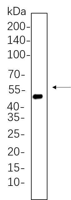 Anti-Human/Rat Cytokeratin 20 Antibody [B561]
