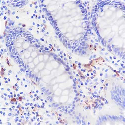 Anti-Human CD169 Antibody [A161] - ABMIUM