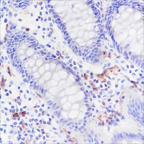 Anti-Human CD169 Antibody [A161] - ABMIUM