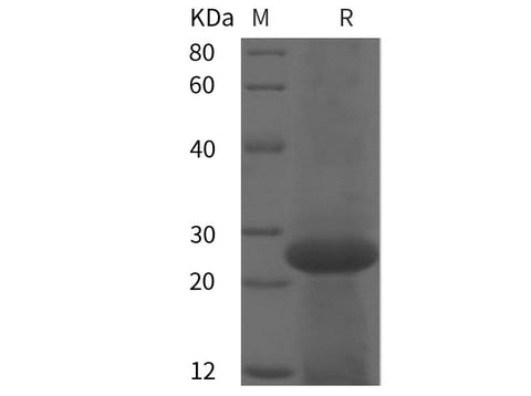 SDS-PAGE analysis of Human OGA proteins, 2 μg/lane of Recombinant Human OGA proteins was resolved with SDS-PAGE under reducing conditions, showing bands at 25 kDa.