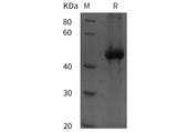 SDS-PAGE analysis of Human Sperm-associated antigen 5/SPAG5 proteins, 2 μg/lane of Recombinant Human Sperm-associated antigen 5/SPAG5 proteins was resolved with SDS-PAGE under reducing conditions, showing bands at 48 kDa.