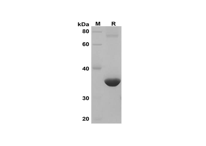 SDS-PAGE analysis of Human CLC proteins, 2 μg/lane of Recombinant Human CLC proteins was resolved with SDS-PAGE under reducing conditions, showing bands at 36 kDa.