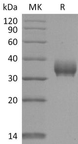 Recombinant SARS-CoV-2 Spike RBD (V367F)(His Tag) - ABMIUM