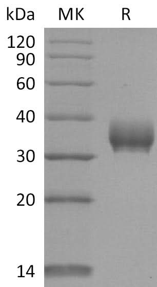 Recombinant SARS-CoV-2 Spike RBD (V367F)(His Tag) - ABMIUM