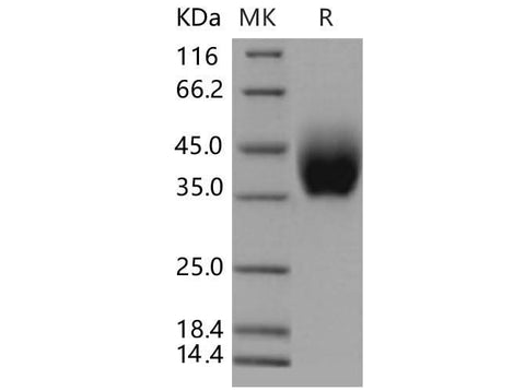 > 98 % as determined by reducing SDS-PAGE.