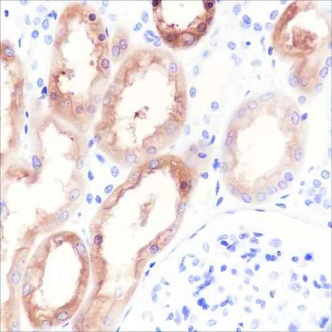 Anti-Human HGD Antibody [A425] - ABMIUM