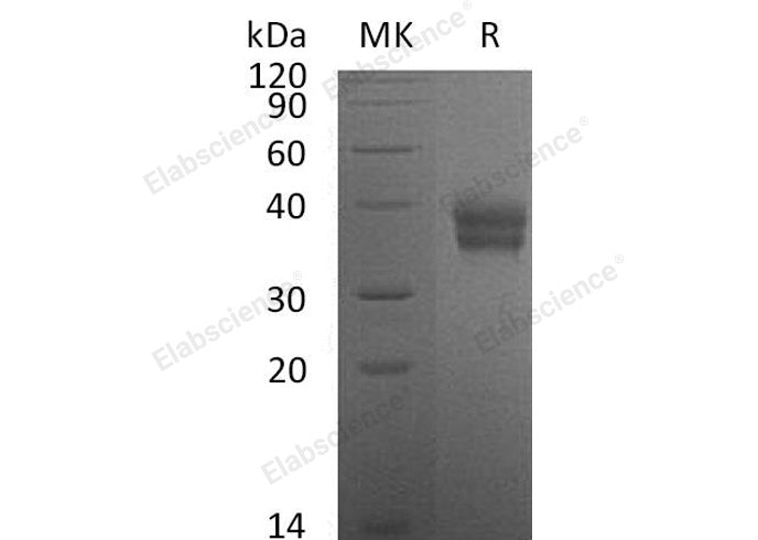 Recombinant Mouse Carbonic Anhydrase XII/CA12 Protein (His Tag) - ABMIUM