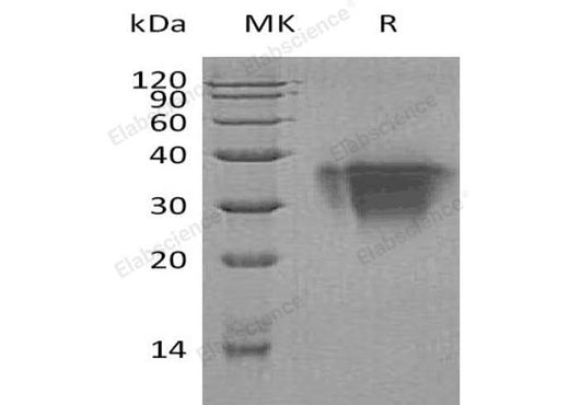 Recombinant Human TWSG1/TSG Protein (His Tag) - ABMIUM
