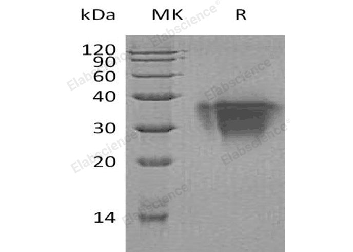 Recombinant Human TWSG1/TSG Protein (His Tag) - ABMIUM