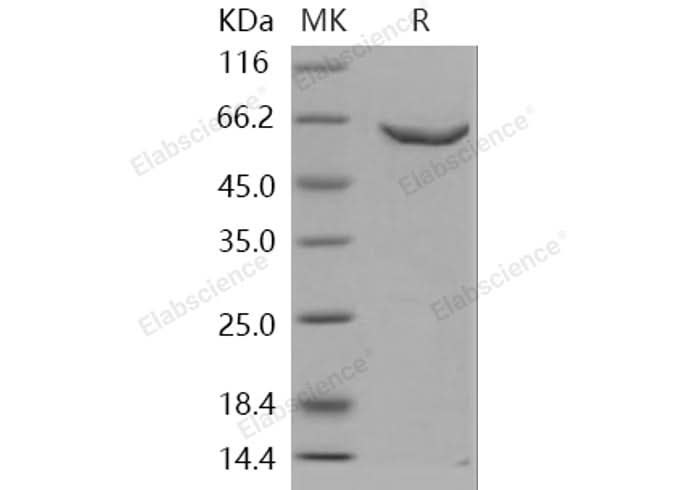 Recombinant Human DNMT2/TRDMT1 Protein (GST Tag) - ABMIUM