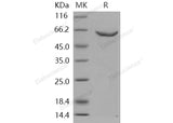 Recombinant Human DNMT2/TRDMT1 Protein (GST Tag) - ABMIUM