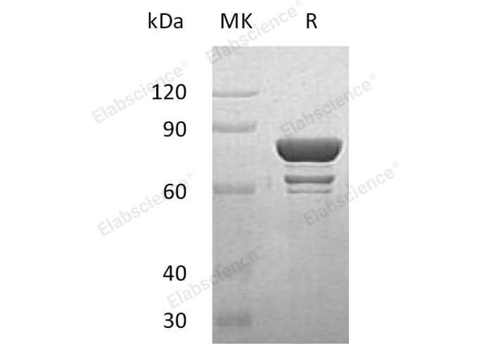 Recombinant Human STAT1 Protein (His &GST Tag) - ABMIUM