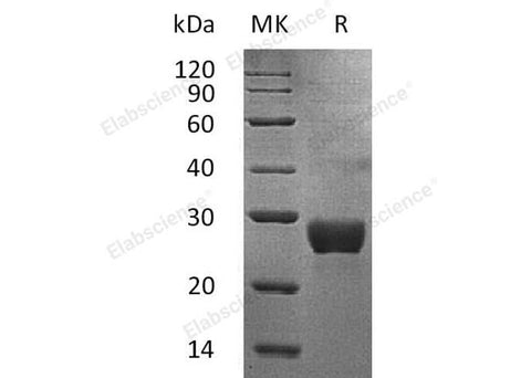 Recombinant Human NKG2DL/ULBP-1 Protein (His Tag) - ABMIUM