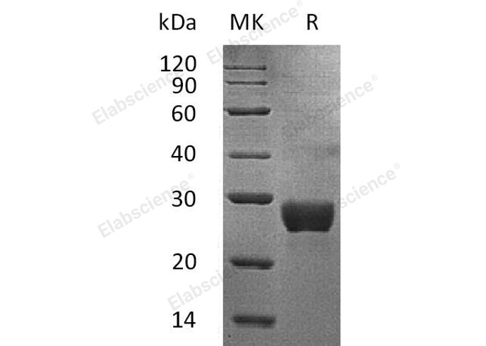 Recombinant Human NKG2DL/ULBP-1 Protein (His Tag) - ABMIUM