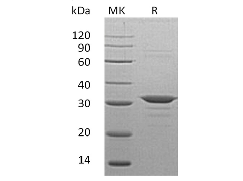 Recombinant Human CLIC4 Protein (His Tag) - ABMIUM