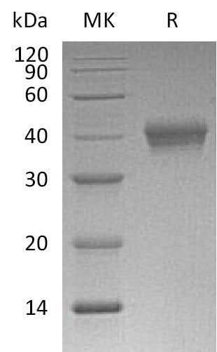 Recombinant Mouse CD38 Protein (His Tag) - ABMIUM