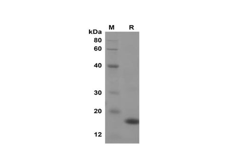 SDS-PAGE analysis of Mouse IL-10 proteins, 2 μg/lane of Recombinant Mouse IL-10 proteins was resolved with SDS-PAGE under reducing conditions, showing bands at 17 kDa.