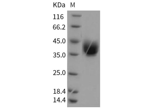 Recombinant Rat ART4 Protein (His Tag) - ABMIUM