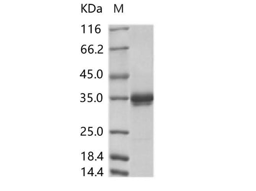 Recombinant ZIKV (strain Zika SPH2016) Stem/anchor domain of flavivirus envelope glycoprotein E protein (Fc Tag) - ABMIUM