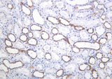 Anti-Human/Mouse/Rat PAI-1 Antibody [B1047]