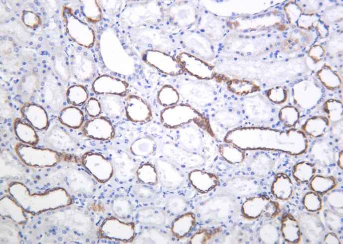 Anti-Human/Mouse/Rat PAI-1 Antibody [B1047]