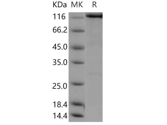 Recombinant Human WWP2 Protein (His & GST Tag) - ABMIUM