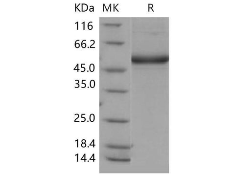 Recombinant Mouse CD302/CLEC13A Protein (Fc Tag) - ABMIUM