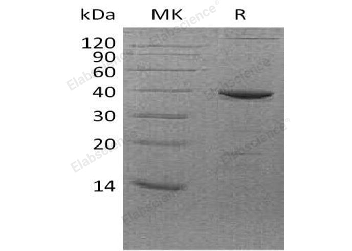 Recombinant Human FBPase 1/FBP1 Protein (E. coli, His Tag) - ABMIUM