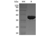 Recombinant Human GALM Protein (His Tag) - ABMIUM