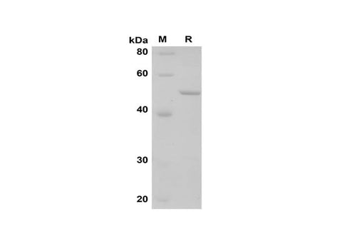 SDS-PAGE analysis of Rat Lipocalin-2 proteins, 2 μg/lane of Recombinant Rat Lipocalin-2 proteins was resolved with SDS-PAGE under reducing conditions, showing bands at 50 kDa.
